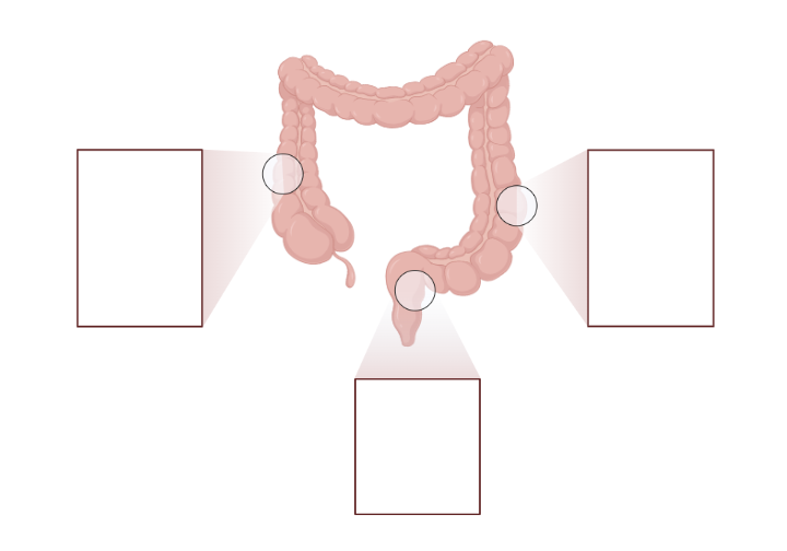 Colon Callout (Layout) | BioRender Science Templates