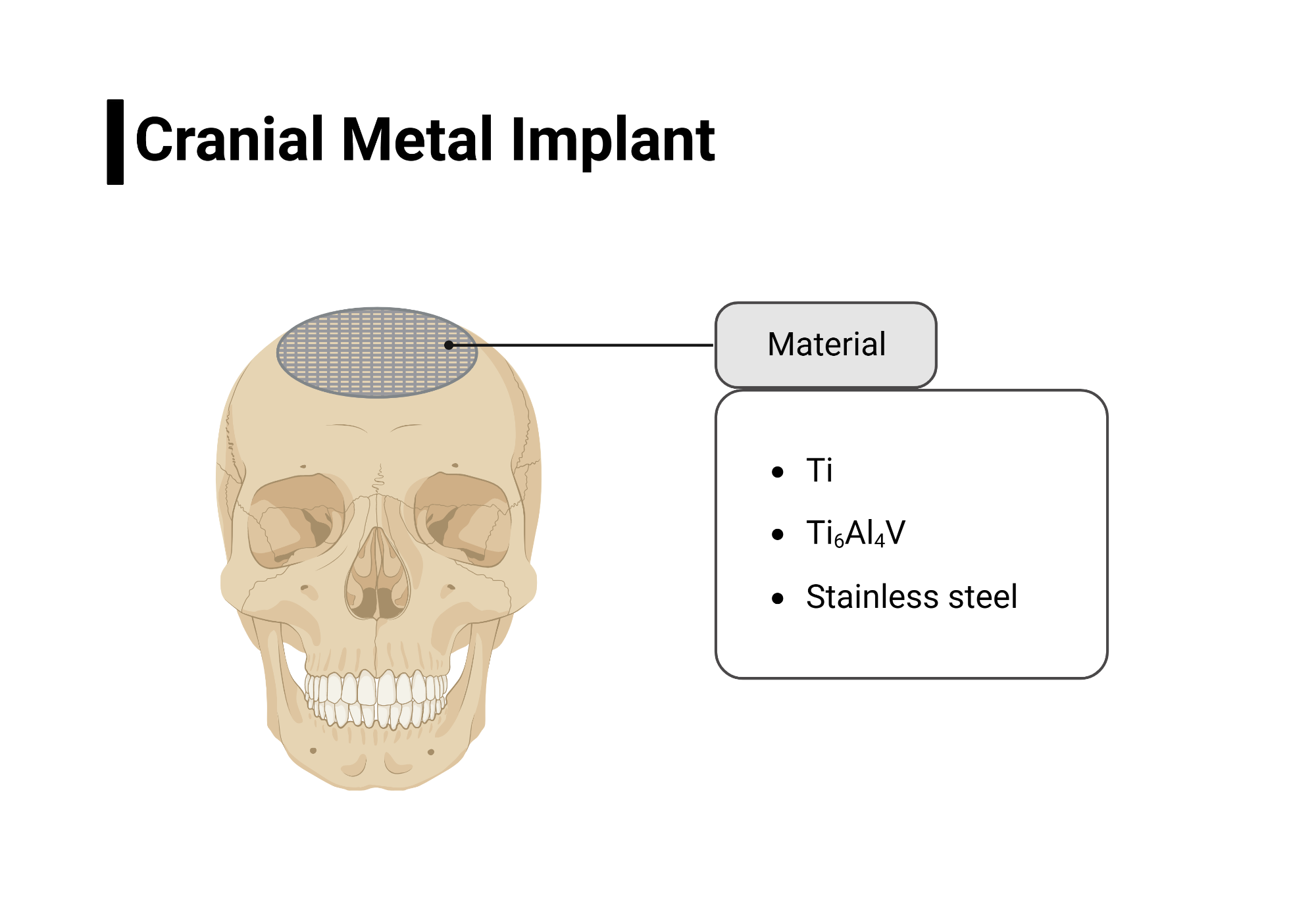 Cranial Metal Implant BioRender Science Templates