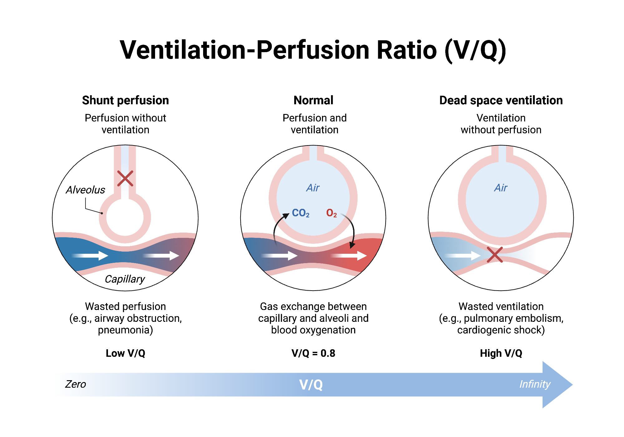 Ventilation Perfusion Ratio V Q BioRender Science Templates
