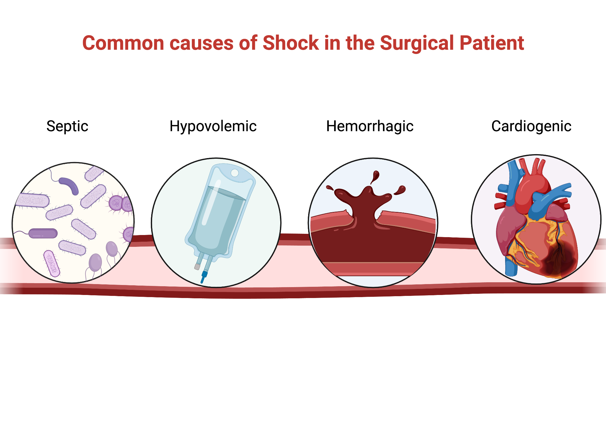 Causes of shock BioRender Science Templates