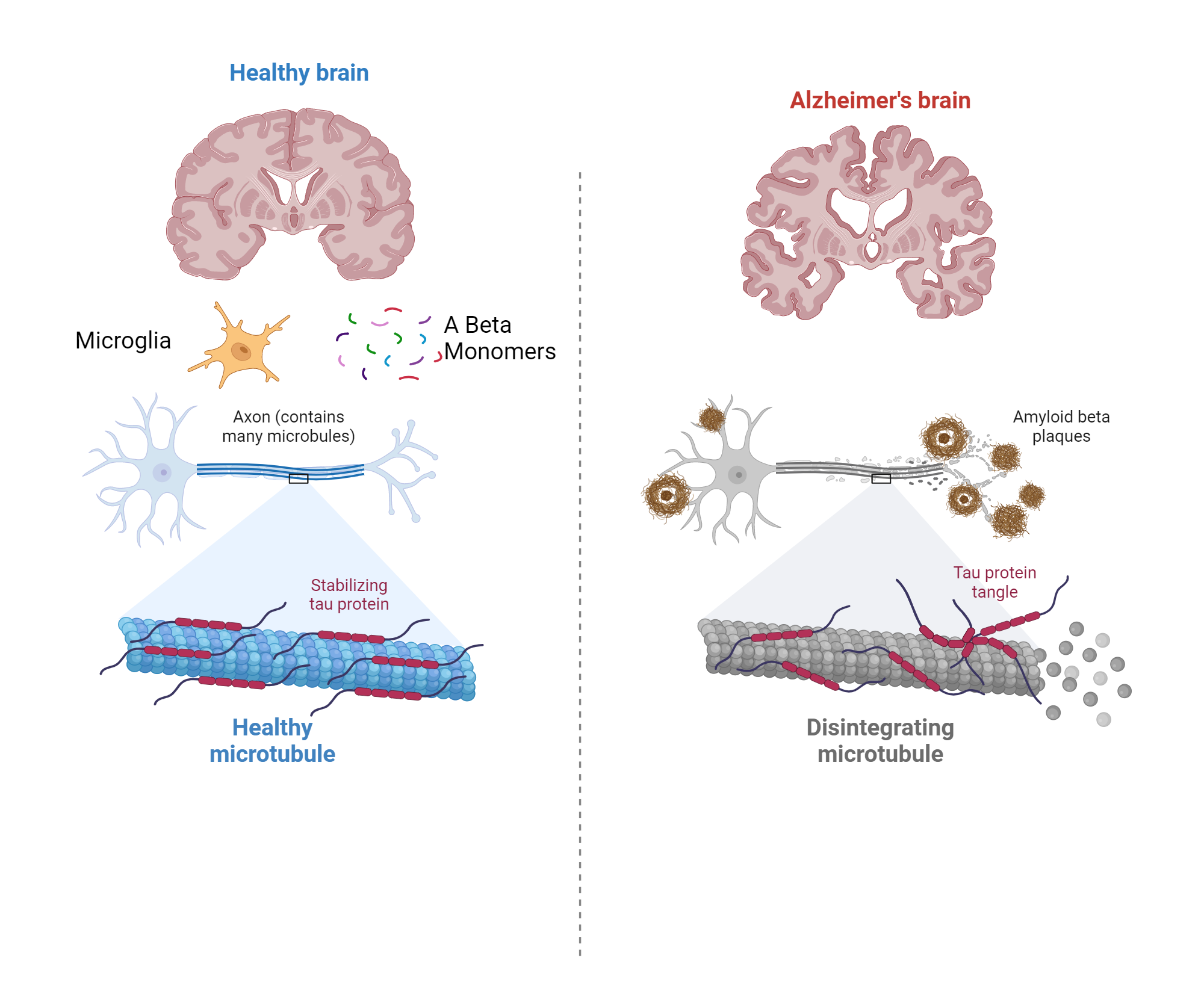 Pathology of alzheimer s disease 2 biorender science templates