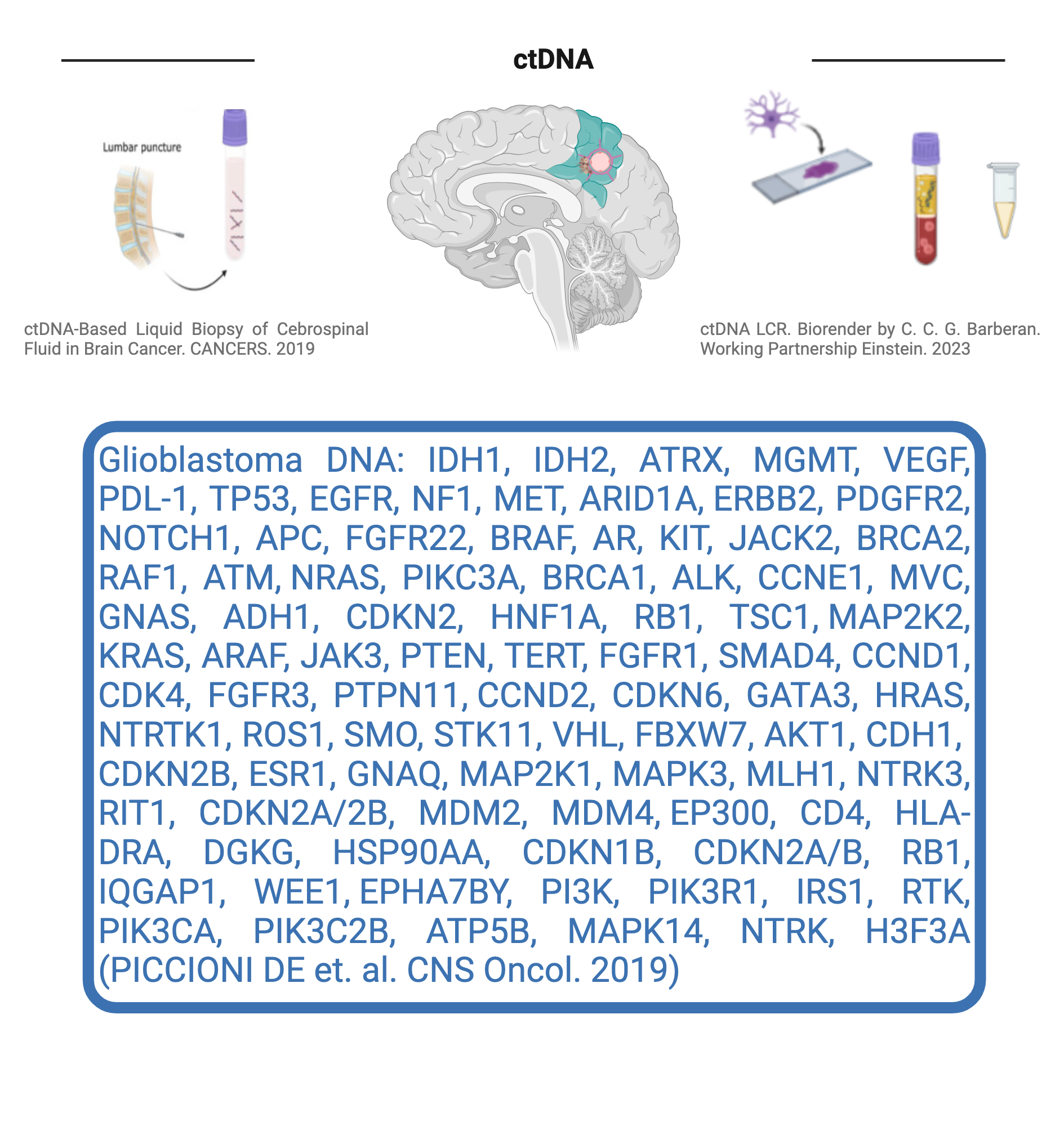 Liquid biopsy in glioblastoma brain tumor. | BioRender Science Templates