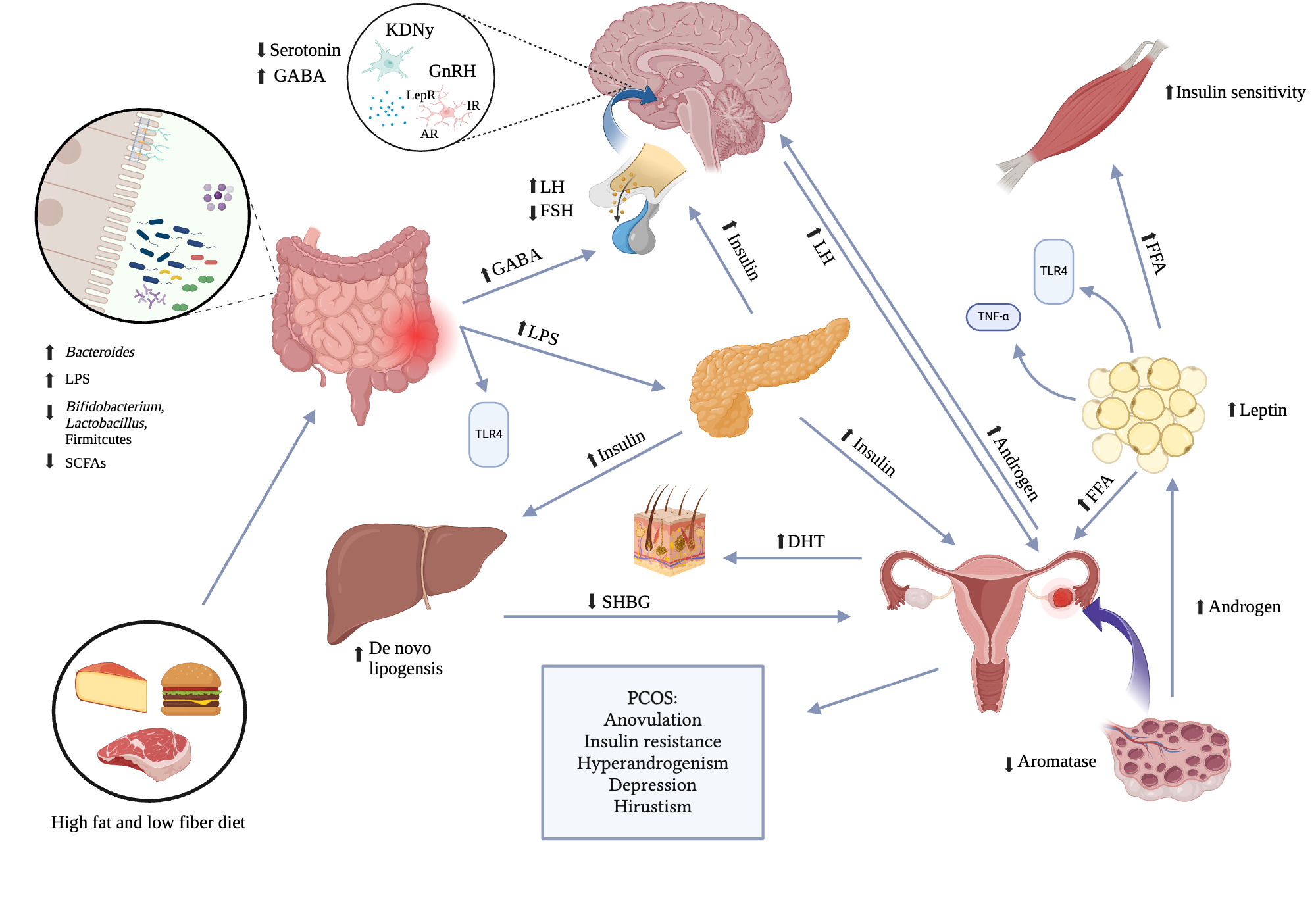 How diet affects the gut microbiome which can lead to PCOS symptoms ...