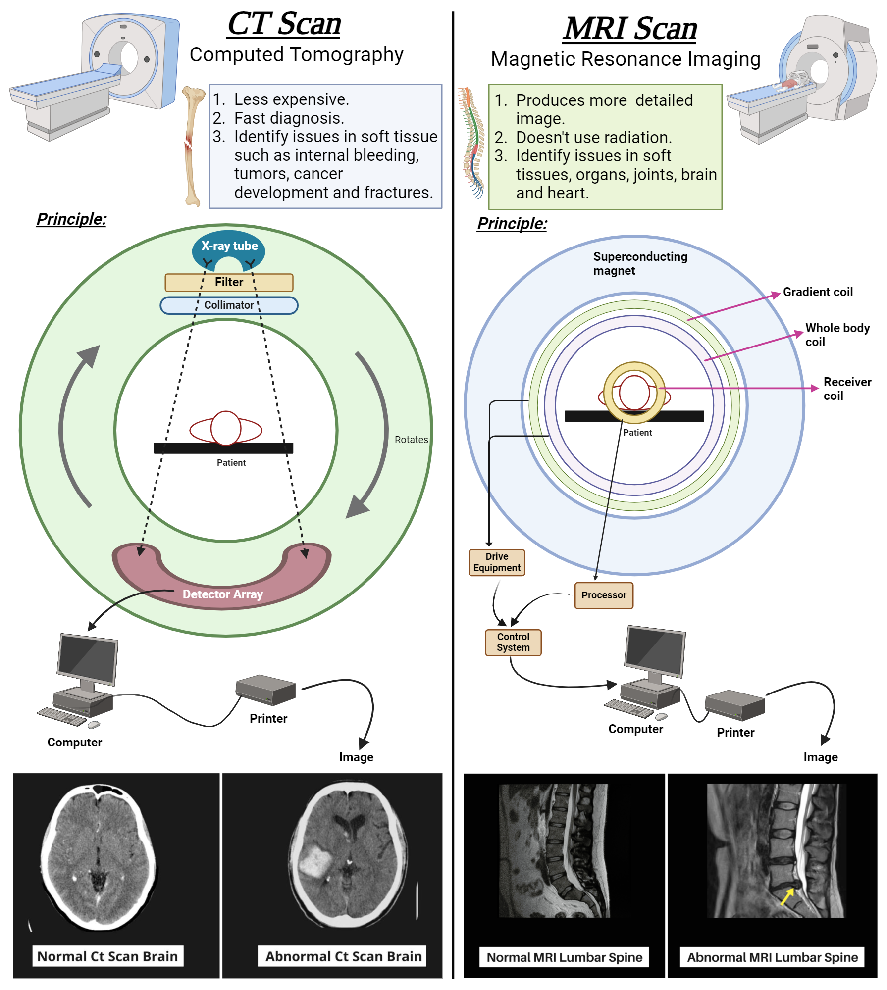 Comparison of CT Scan and MRI Scan | BioRender Science Templates