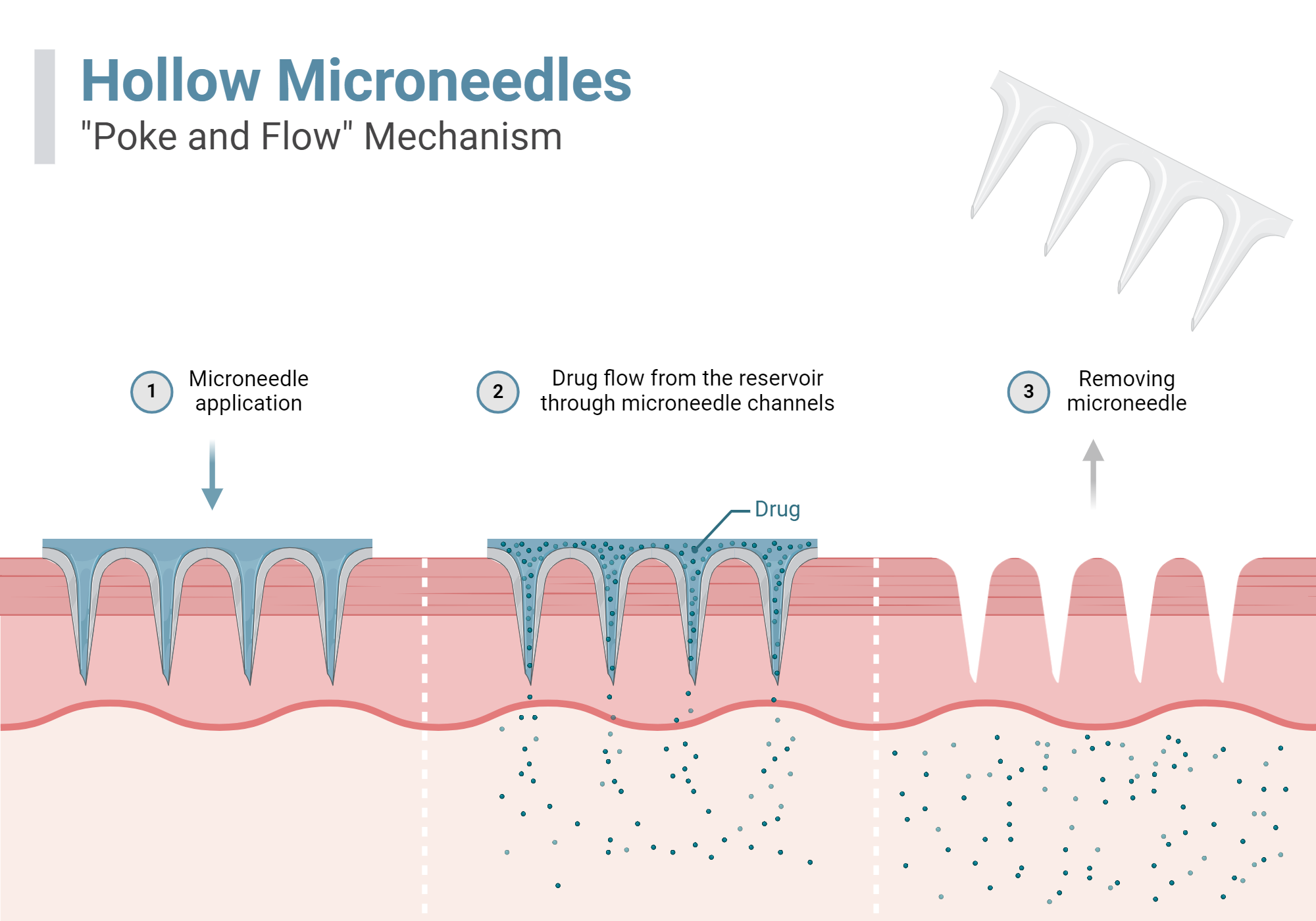 Drug Delivery Using Hollow Microneedles BioRender Science Templates