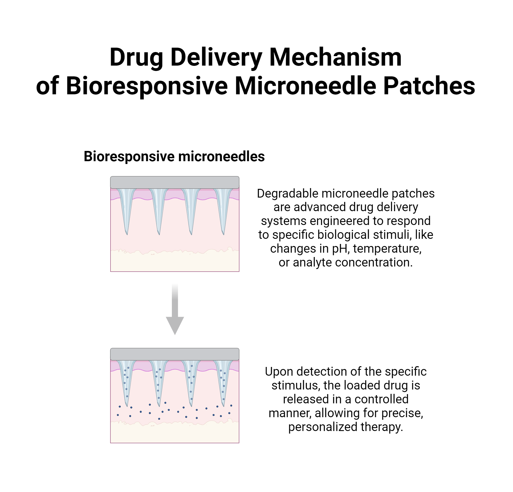 Drug Delivery Mechanism of Bioresponsive Microneedle Patches ...