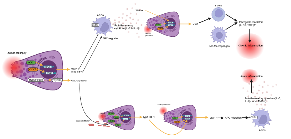 Pancreatitis Pathology Biorender Science Templates
