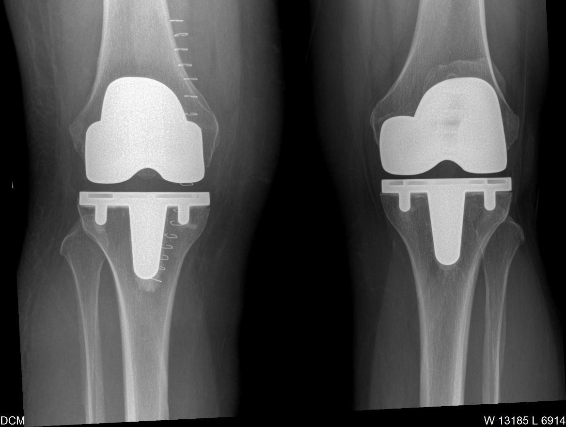 Arthritis Care