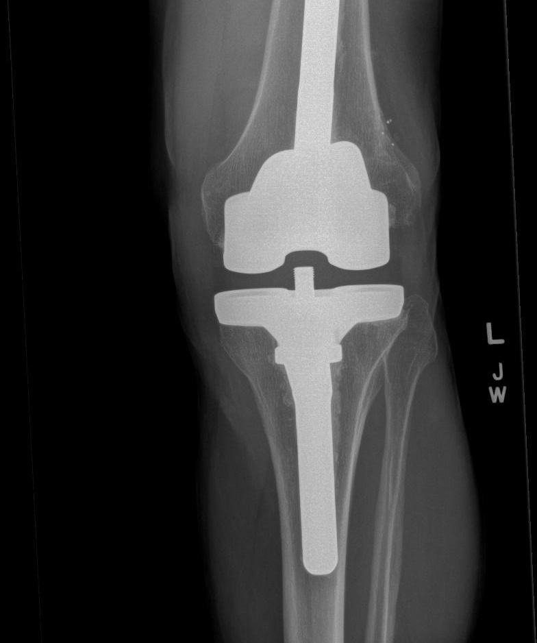 Arthritis Care