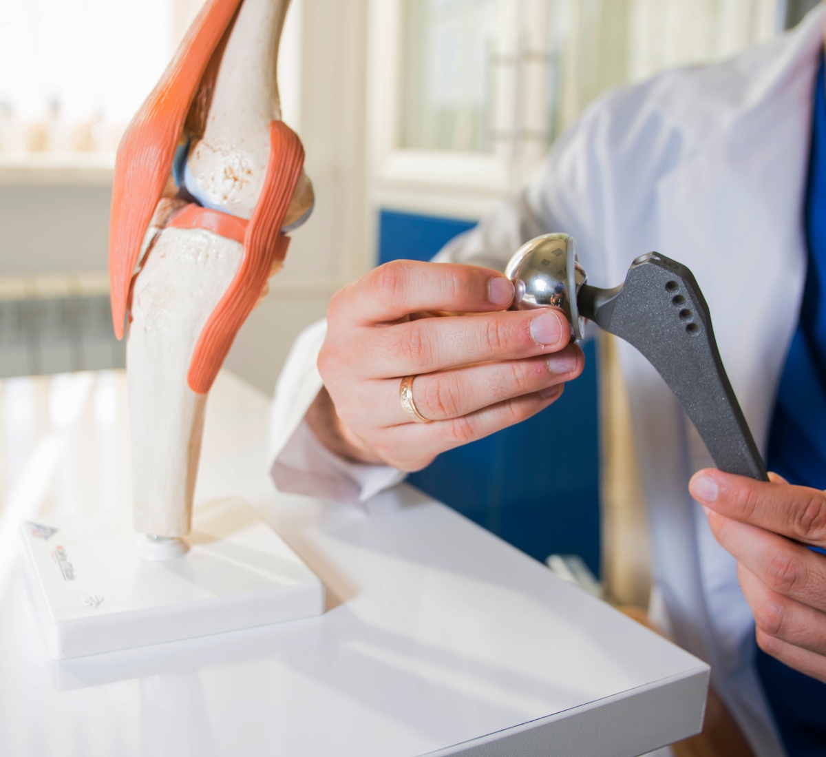 Hip Arthritis And Replacement