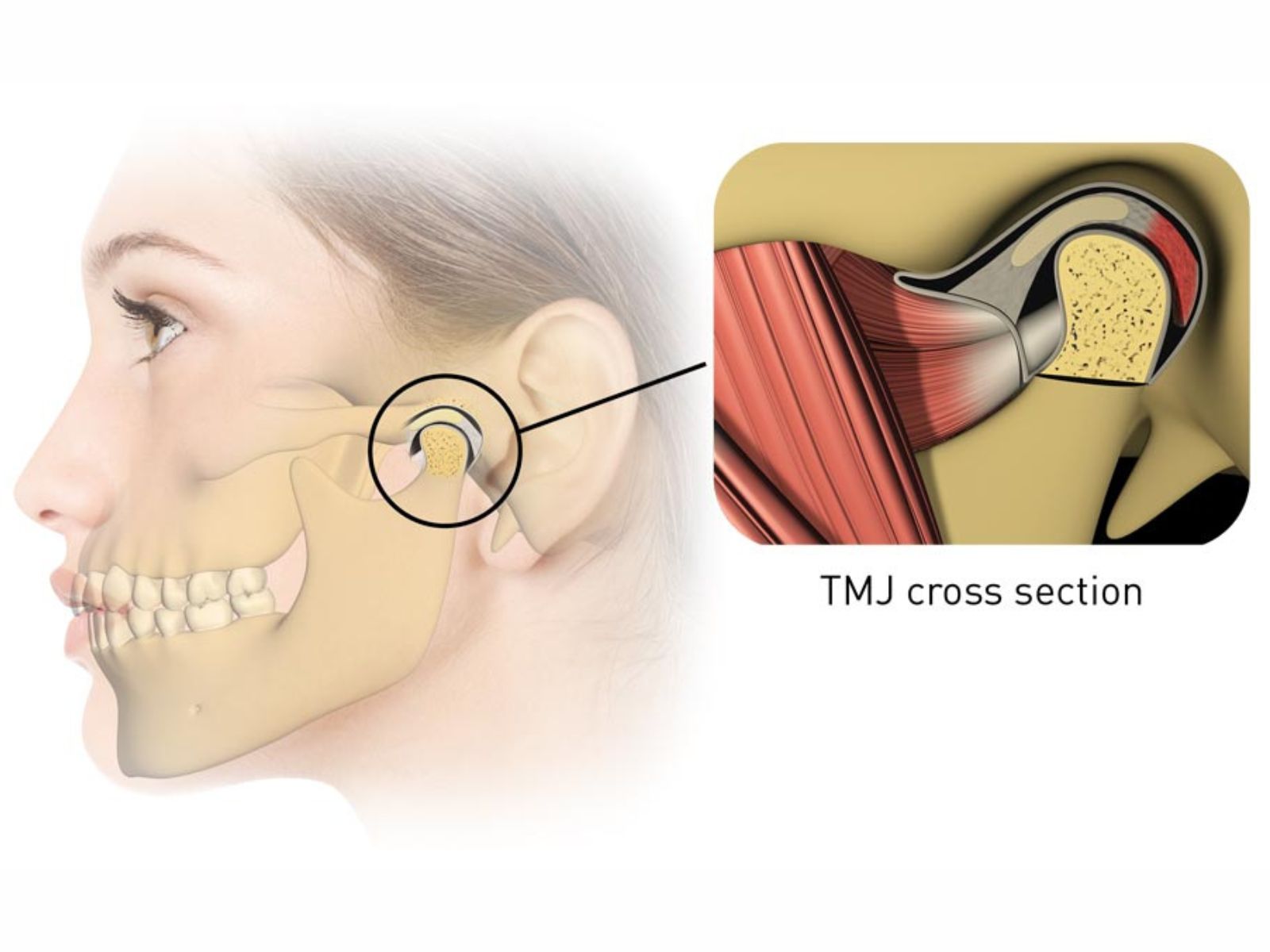 Can TMJ Cause Hearing Loss?