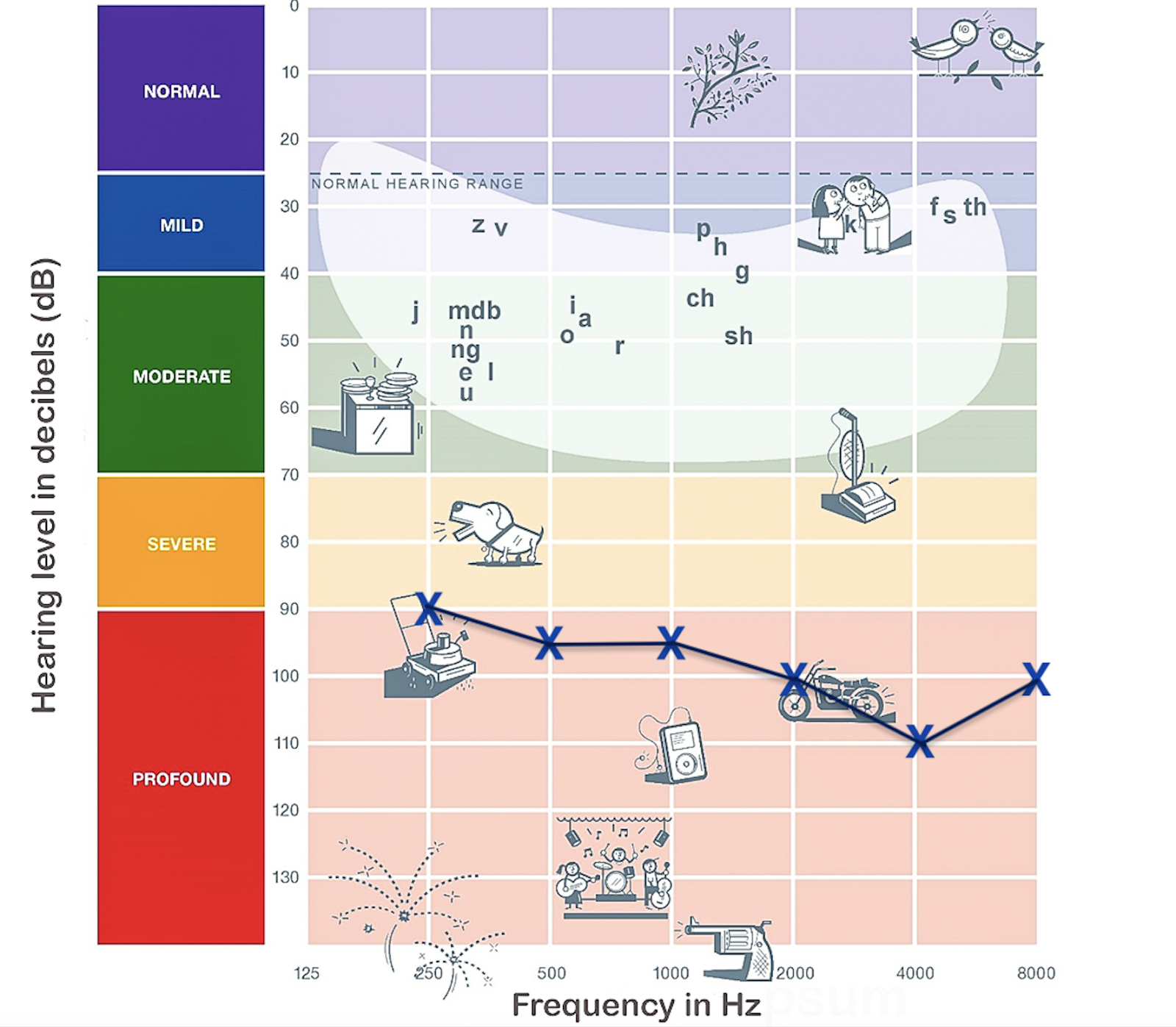 Costco Hearing Aids for Profound Hearing Loss
