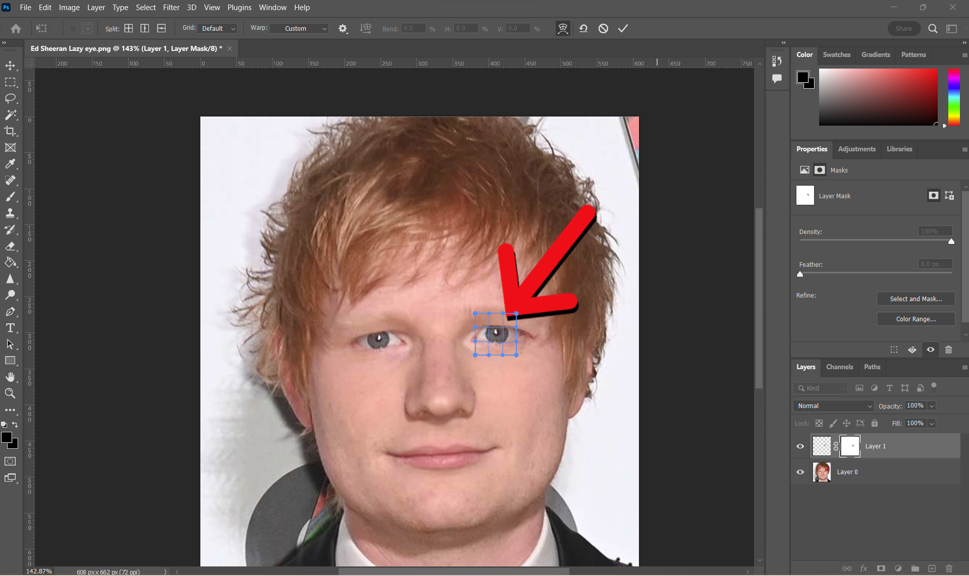 Fix Lazy Eye In Pictures