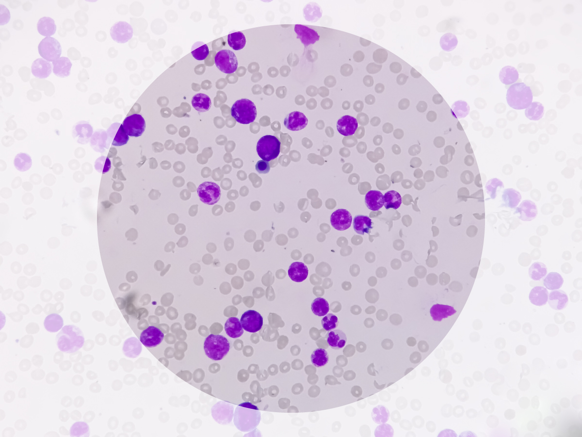15 Leukocytes In Urine Normal Range Price Guarantee Www micoope gt
