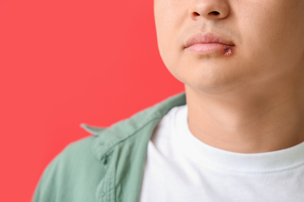 Valacyclovir Dosage for Cold Sores, Herpes, and Other Conditions