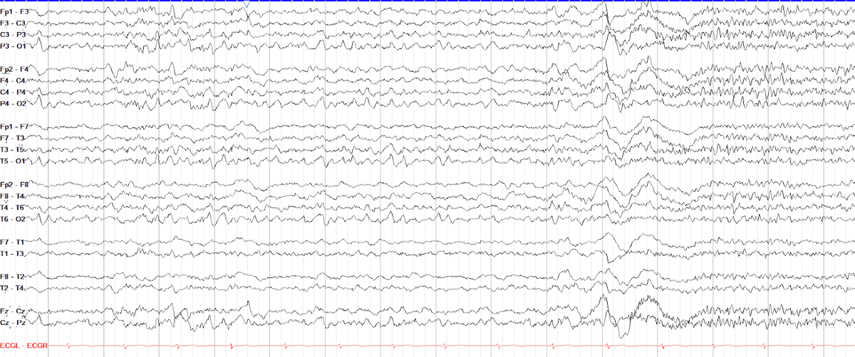 EEG Fun Facts Apr 21, 2023