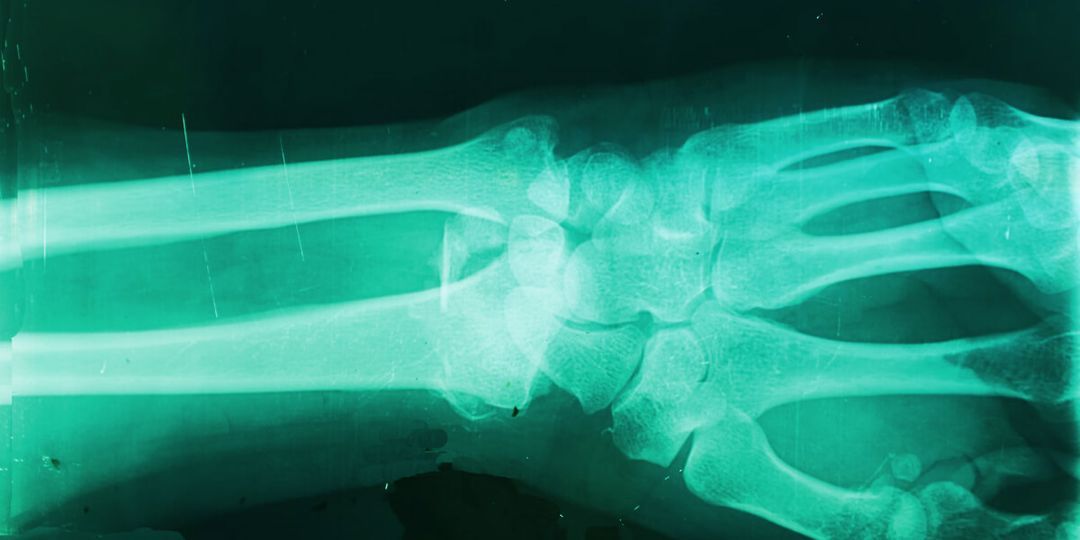 Milvue medical imaging beyond