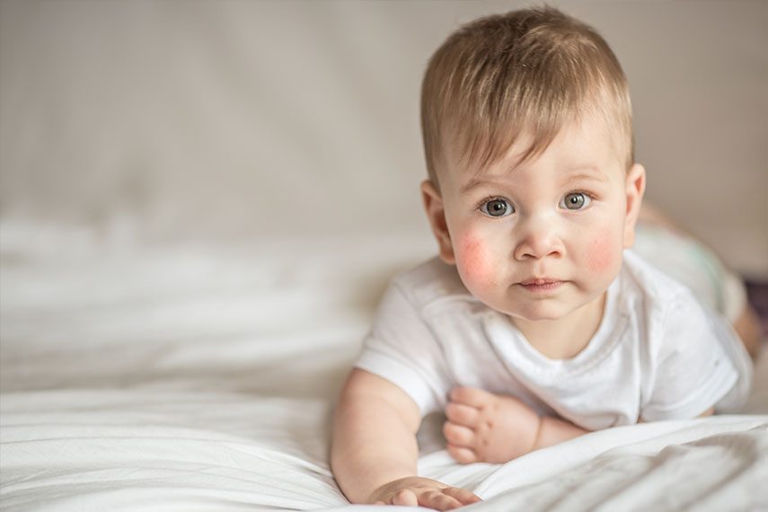 Baby Eczema vs Other Skin Conditions Blueberry Pediatrics