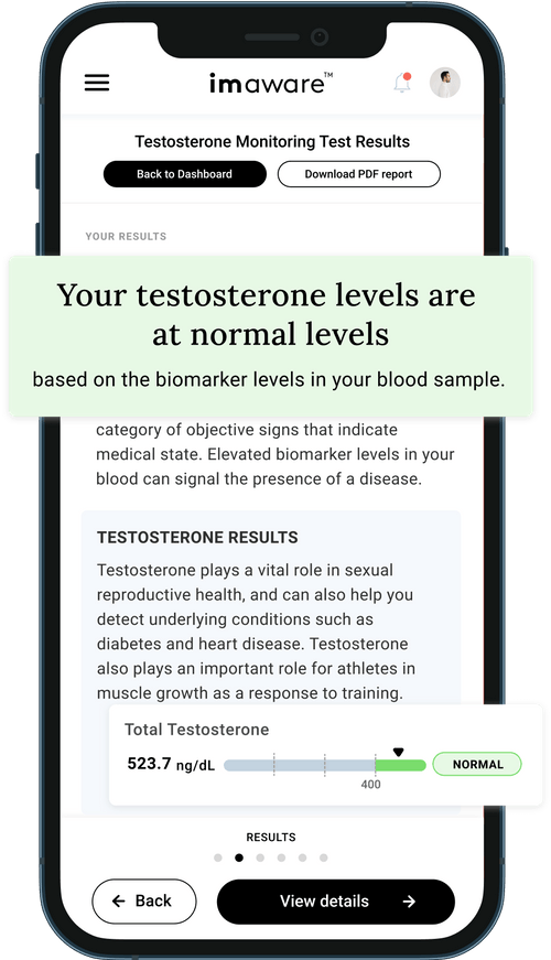 At Home Testosterone Monitoring Test Kit DoctorReviewed imaware