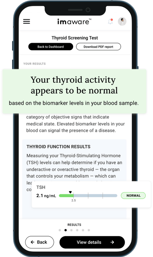 At Home Thyroid Test Kit DoctorReviewed imaware