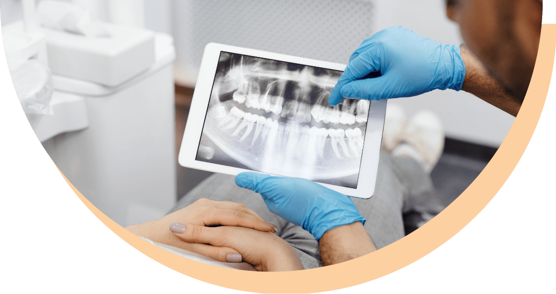 Oral Pathology Oral Exams Bay Area OSM
