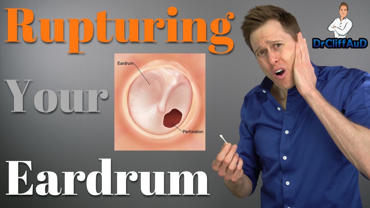 Ruptured Eardrum Tympanic Membrane Perforations