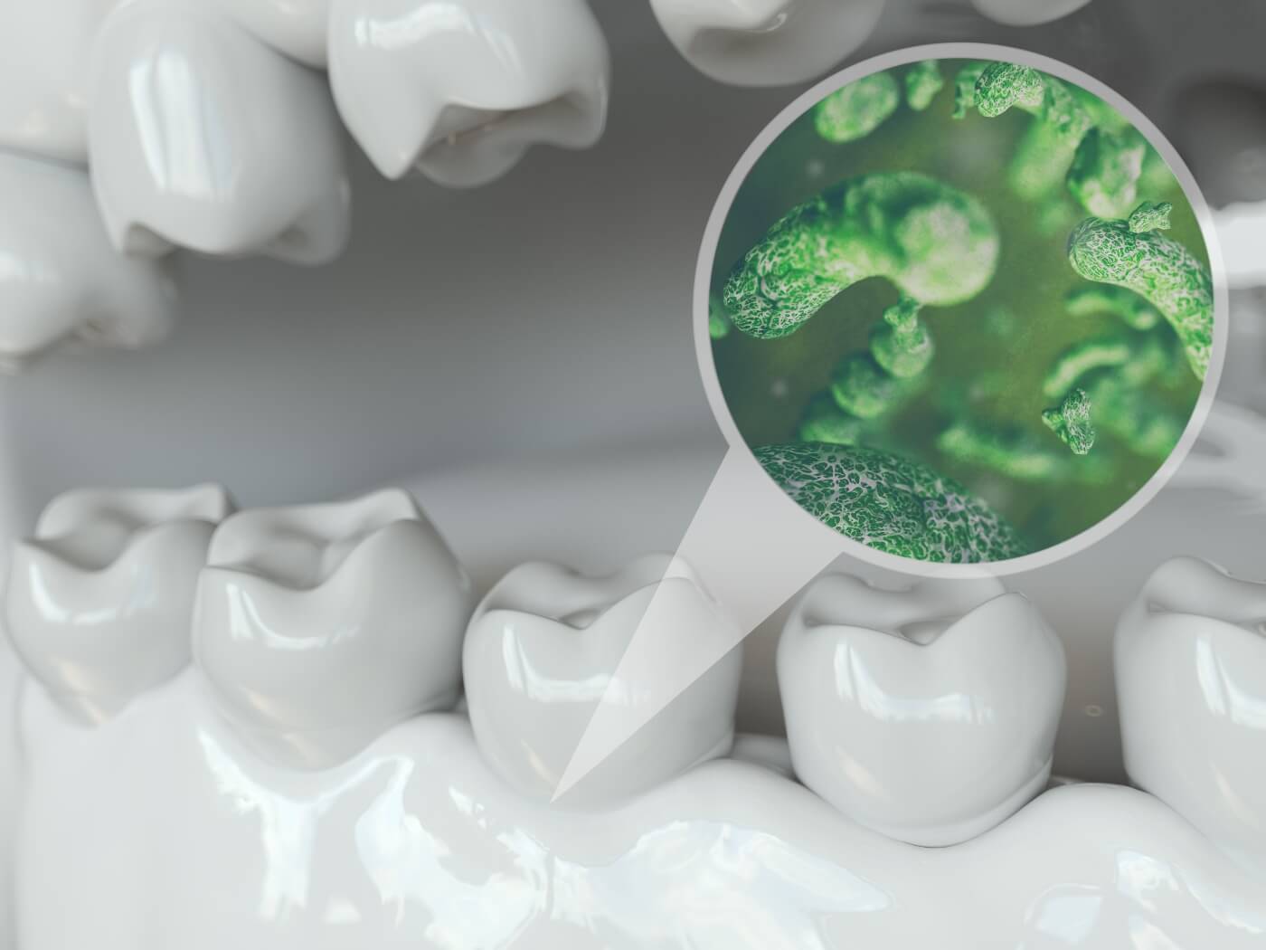Preventive Dentistry in Zachary Z Dentistry