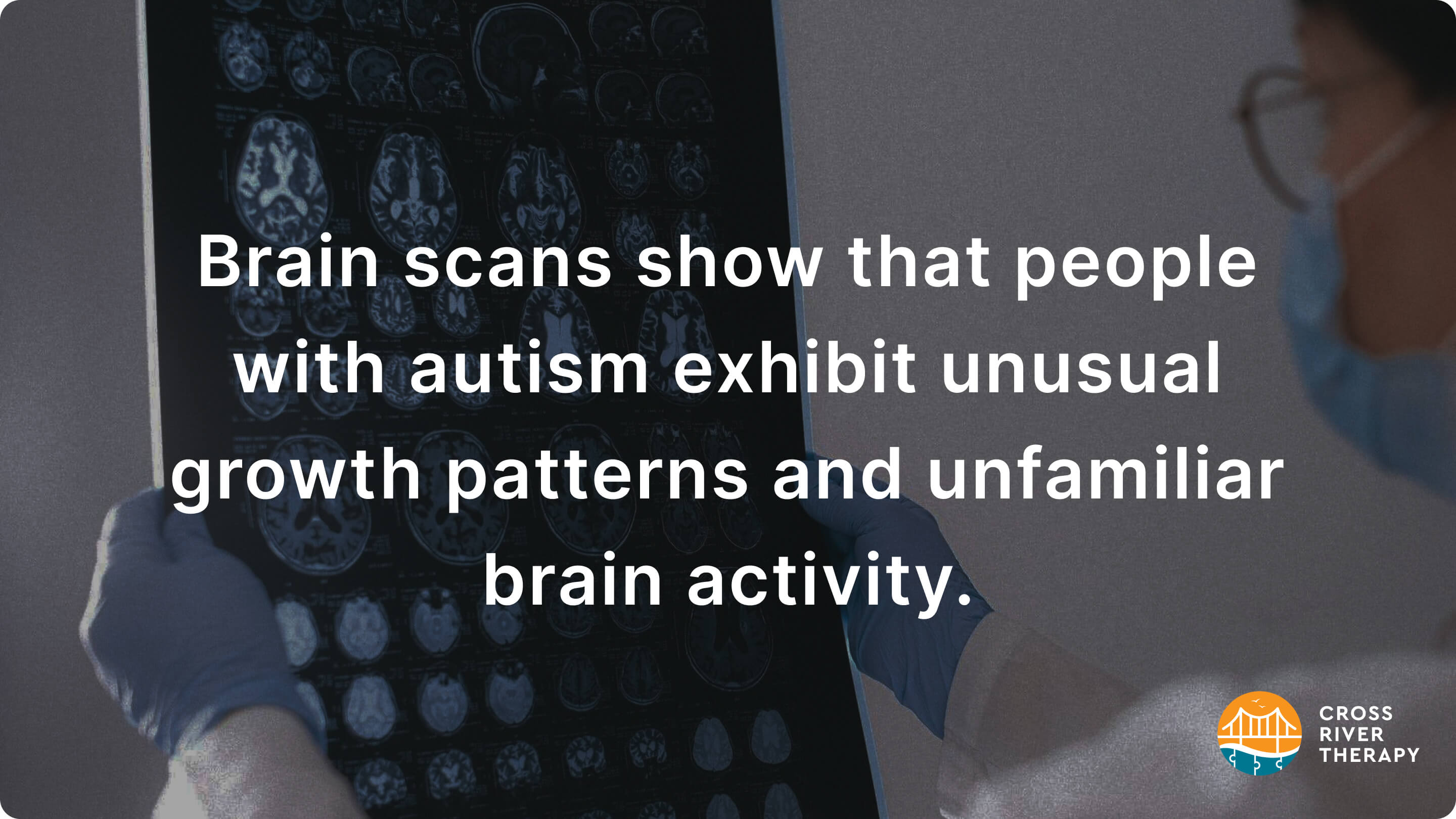 Will Autism Show On MRIs? Can MRIs Diagnose Autism?