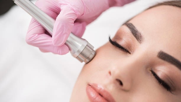 facial microdermabrasion