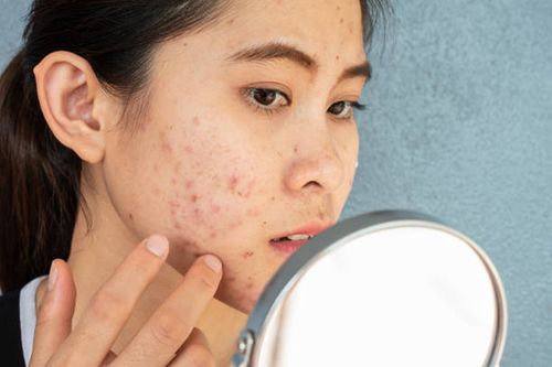 10 Best Acne Treatment Clinics In Singapore [As Of 2023]