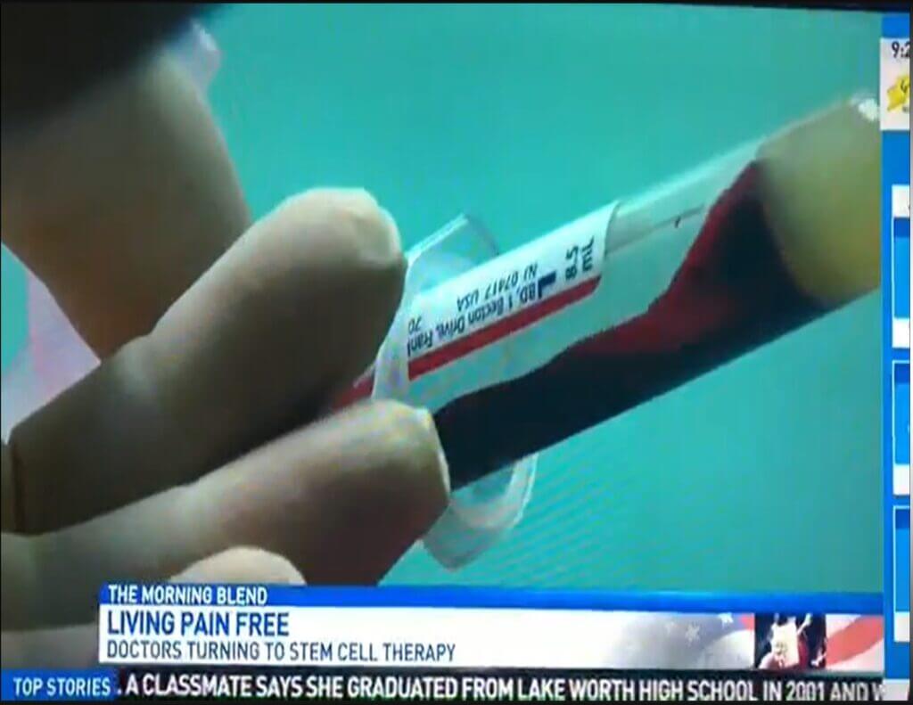 Platelet rich plasma injections near me The Ultimate Solution For Pain-Free Healing