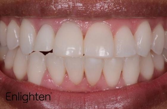 Book an appointment | Best general and cosmetic dentist in Falmouth