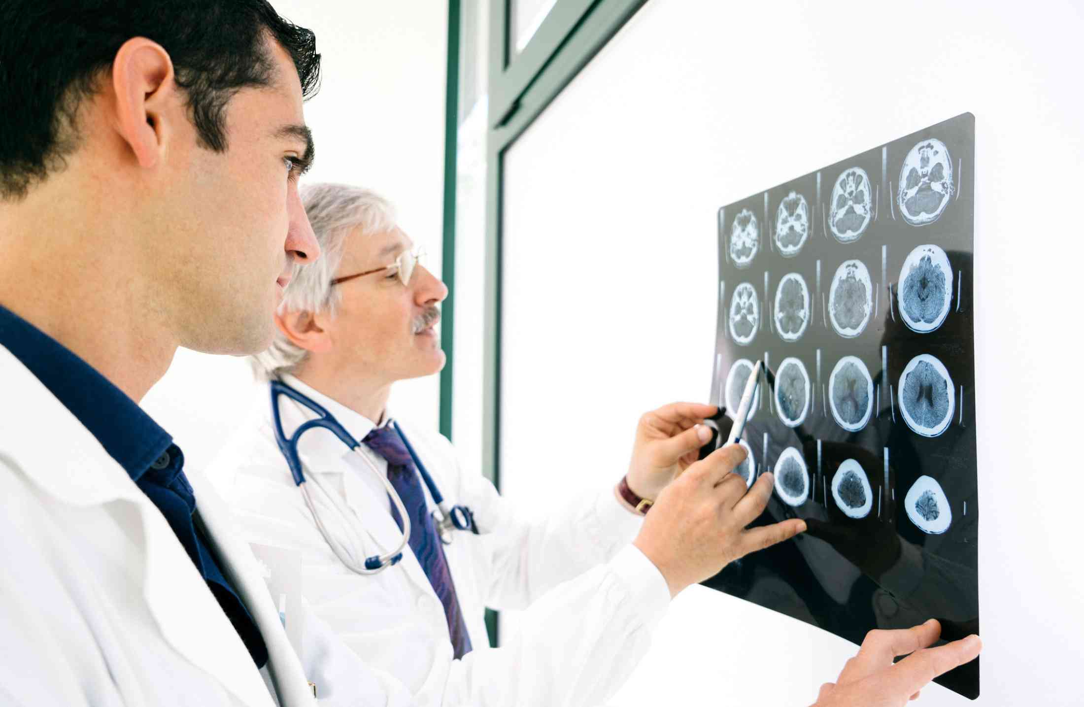 Médico neurologista quais as principais doenças