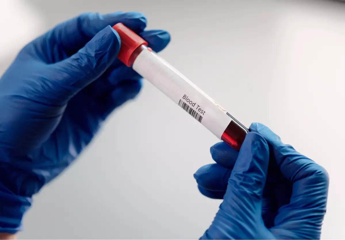 a doctor holding a vial of blood