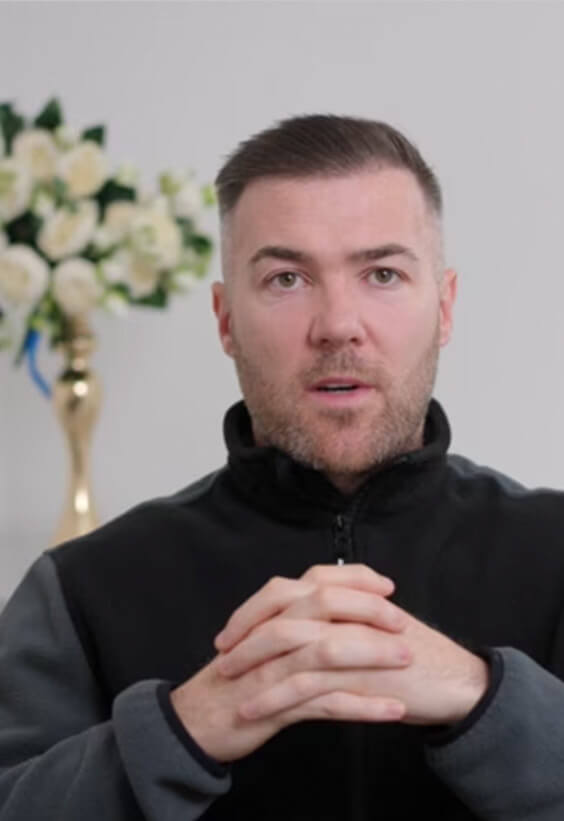 Hair Transplant Before and After Journey’s Este Medical Group