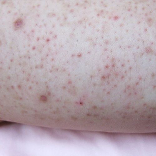 Radiant Dermatology