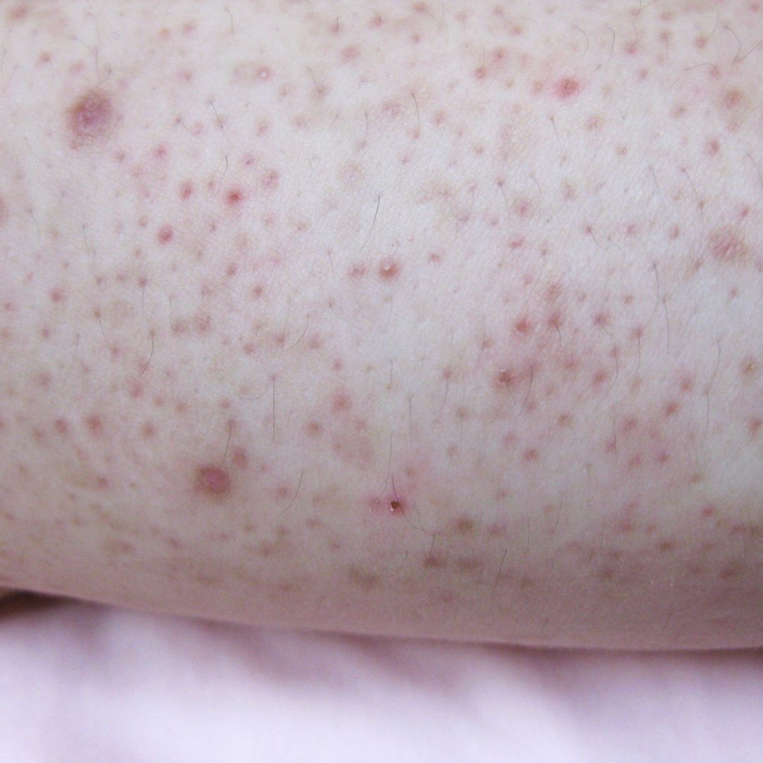 Radiant Dermatology