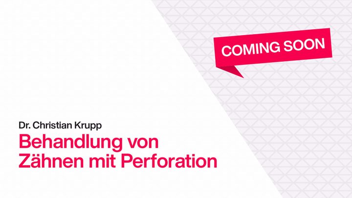 Bonbela Motorkettenrad 13 Zähne - Ersatz Für MY1020 Motor Mit 25H Kette