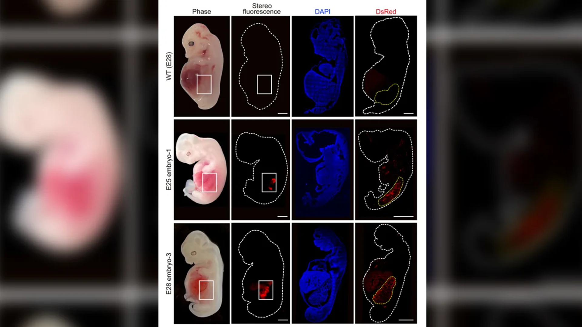 Groundbreaking Study: Human Kidneys Grown in Pig Embryos