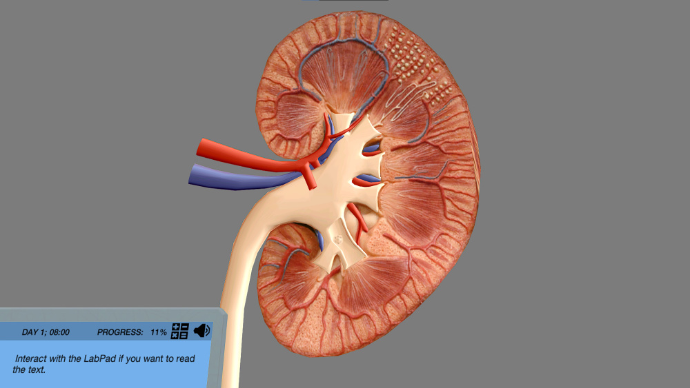 5 Engaging Ways to Teach About Treatment for Chronic Kidney Disease