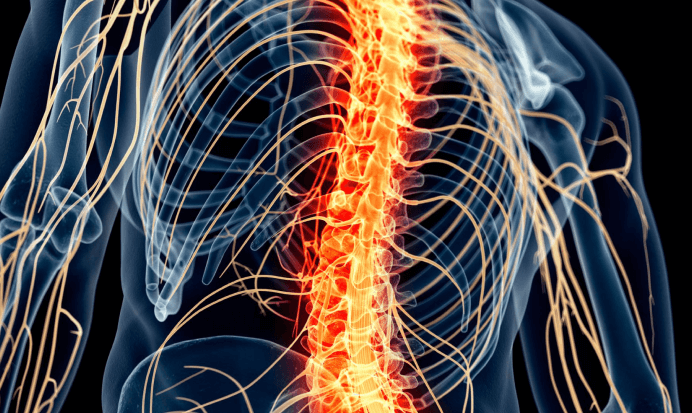 Spinal Stenosis | Royal Spine Surgery