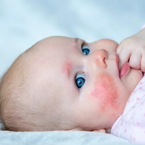 Articles Menu - Telebaby Paediatrician Australia