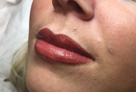 Permanent Makeup Lips | Camilla Seton Medical and Cosmetics