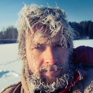 frost bite