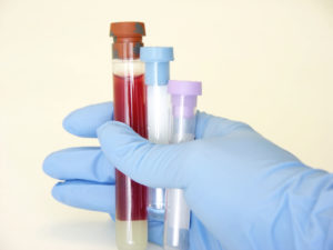 Urgent Care Lab Services Stratford CT