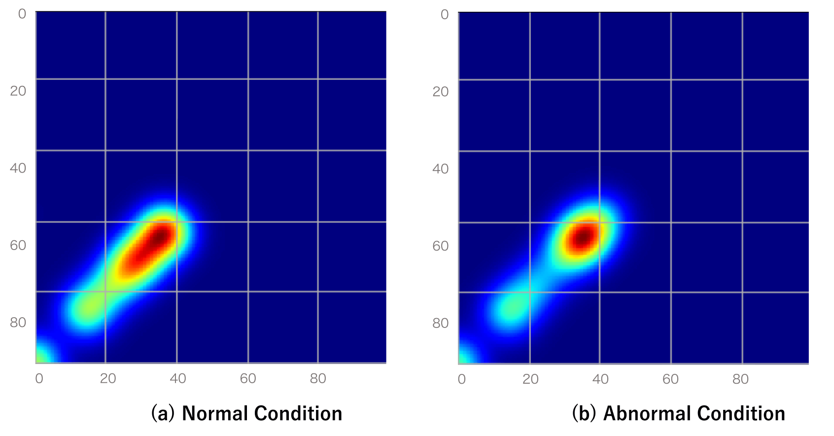 Development of a Tool Anomaly Detection Algorithm for Gantry Type ...