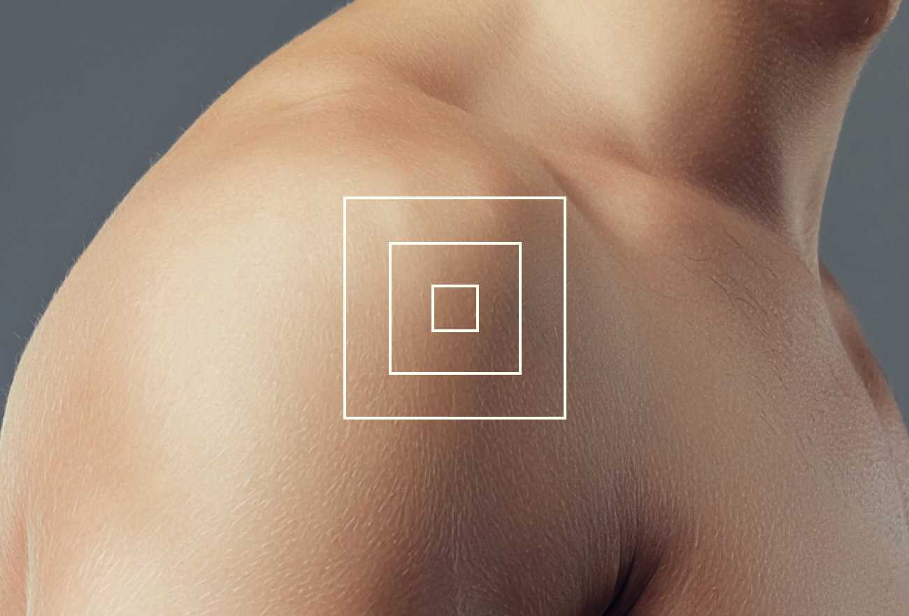 Lyme Disease Prophylaxis Does it Work? Ezra