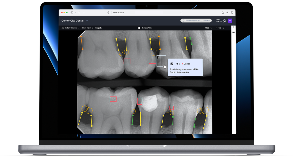 VideaHealth The Dental AI Trusted By Dentists And DSOs VideaHealth The Dental AI Trusted By Dentists And DSOs