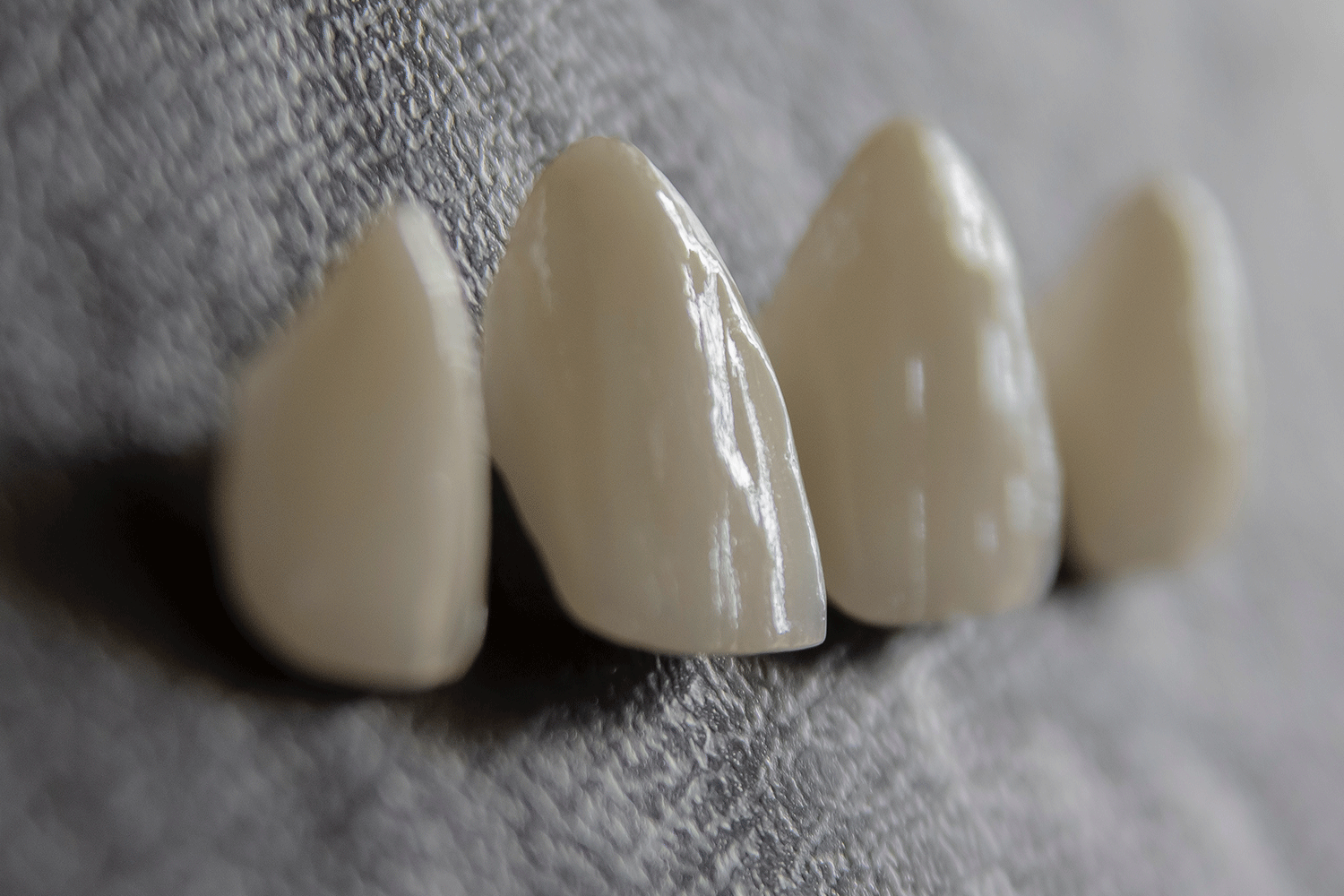 Porcelain Teeth | Enhance Your Smile with Our Dental Lab Services