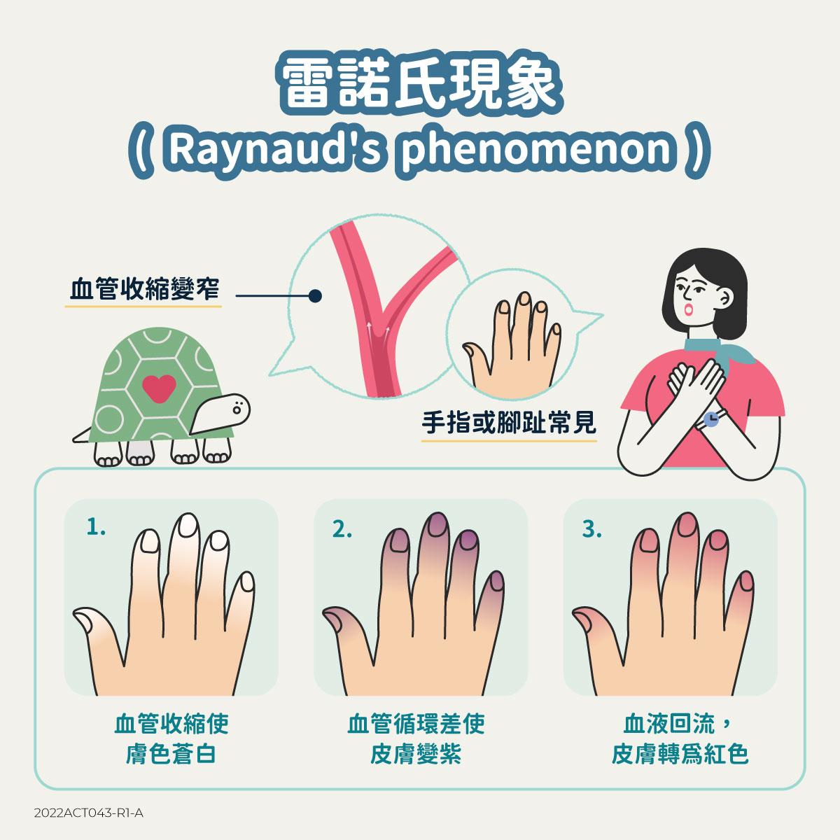 認識硬殼 - 硬皮病的症狀